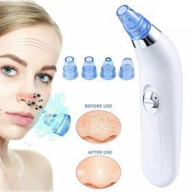 Blackhead Electric Pore Export Blackhead Cleaner (Color: White)